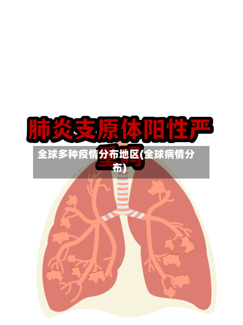 全球各类疫情分布区域（全球疾病分布）